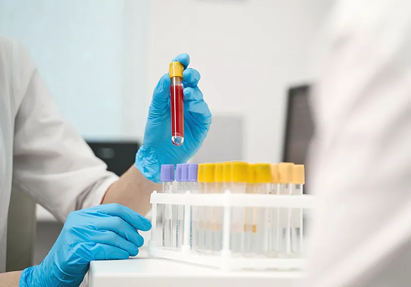 Proactive cardiovascular risk screening in primary care settings.